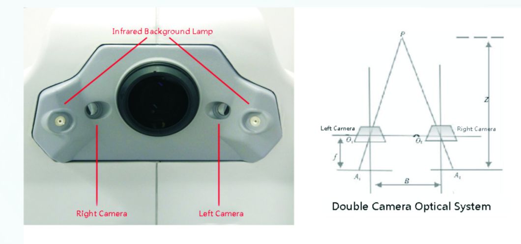 Reticam 3100 China Top Quality Ophthalmic Equipment Auto Fundus Camera