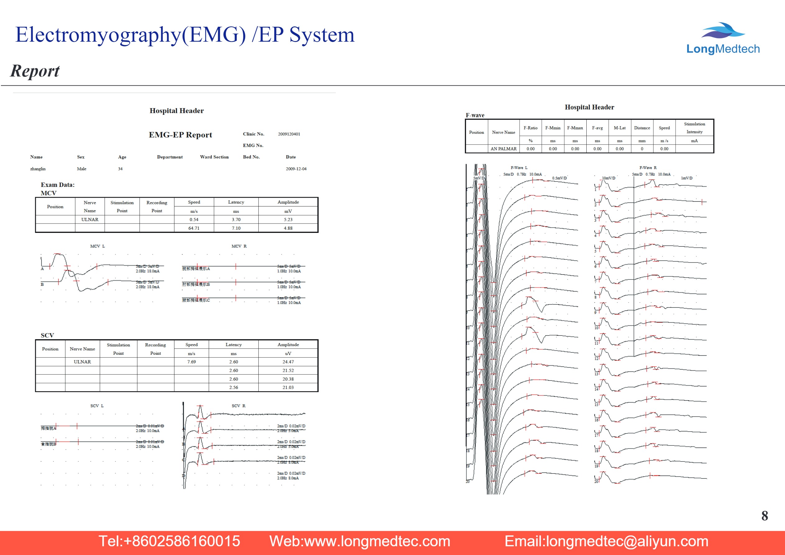 LCEG-248 تخطيط كهربية العضل (EMG) نظام EP-8