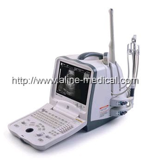 Digital Ultrasonic Diagnostic Imaging System