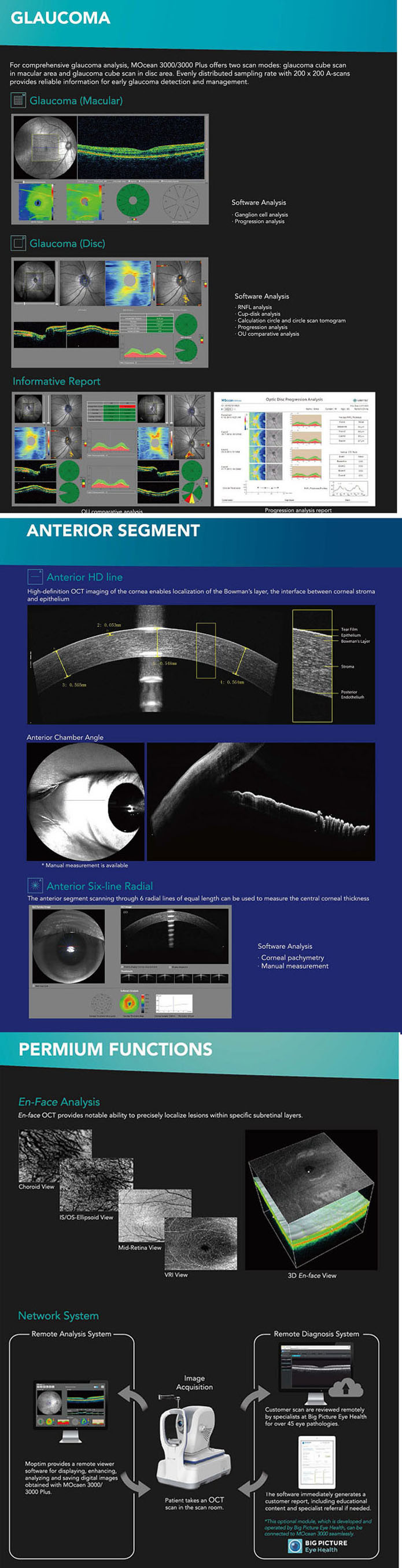 Mocean-3000 China Tomografía de coherencia óptica Mocean 3000 de alta calidad
