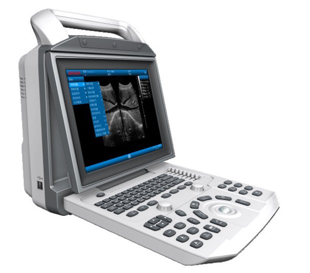 PT6150 Portable Ultrasound System 