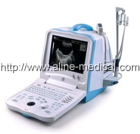 Portable Ultrasound System
