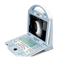 CAS-2000C Balayage AB portable ophtalmique
