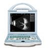 CAS-2000C Ophthalmic Portable AB Scan
