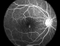 APS-B Equipo de oftalmología no midriática Cámara de fondo con función de angiografía con fluoresceína