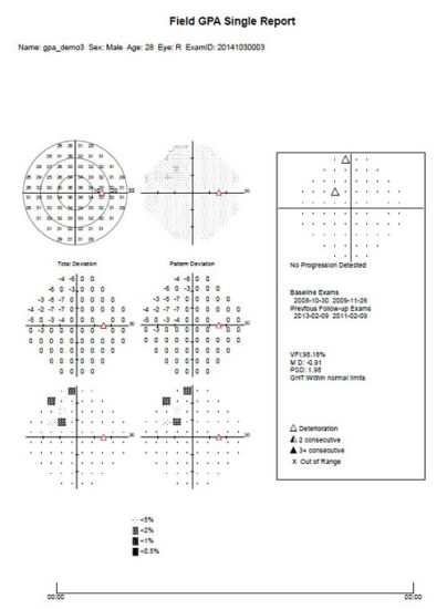 Analyseur de champ visuel Humphrey de matériel ophtalmique de qualité supérieure Aps-T90 Chine