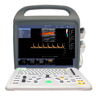 PT5200 Portable Color Doppler Ultrasound Scanner