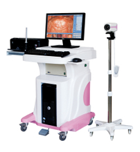Digital Colposcope in Hospital (Model: Jy-2650)