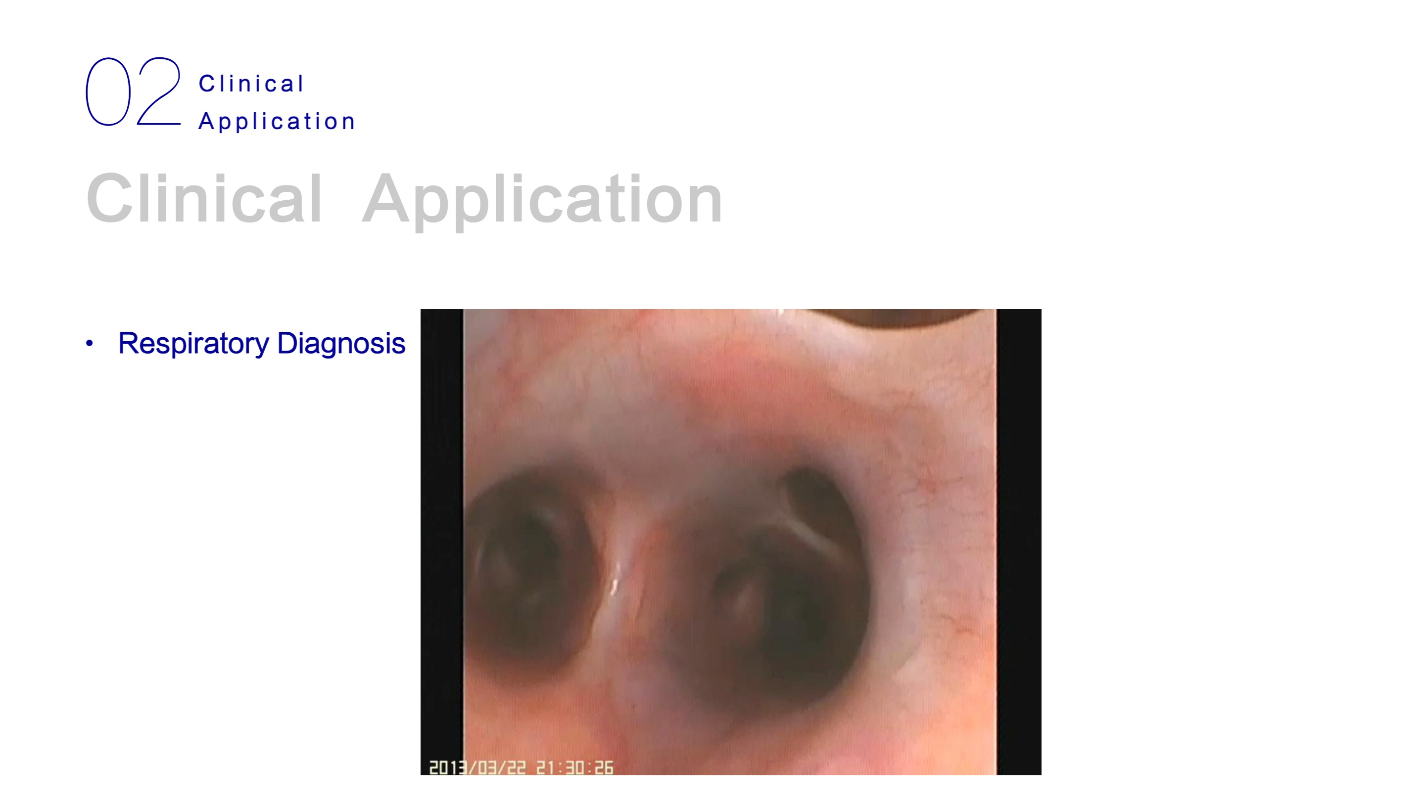 نظام التنظير المتنقل LHO-10-17