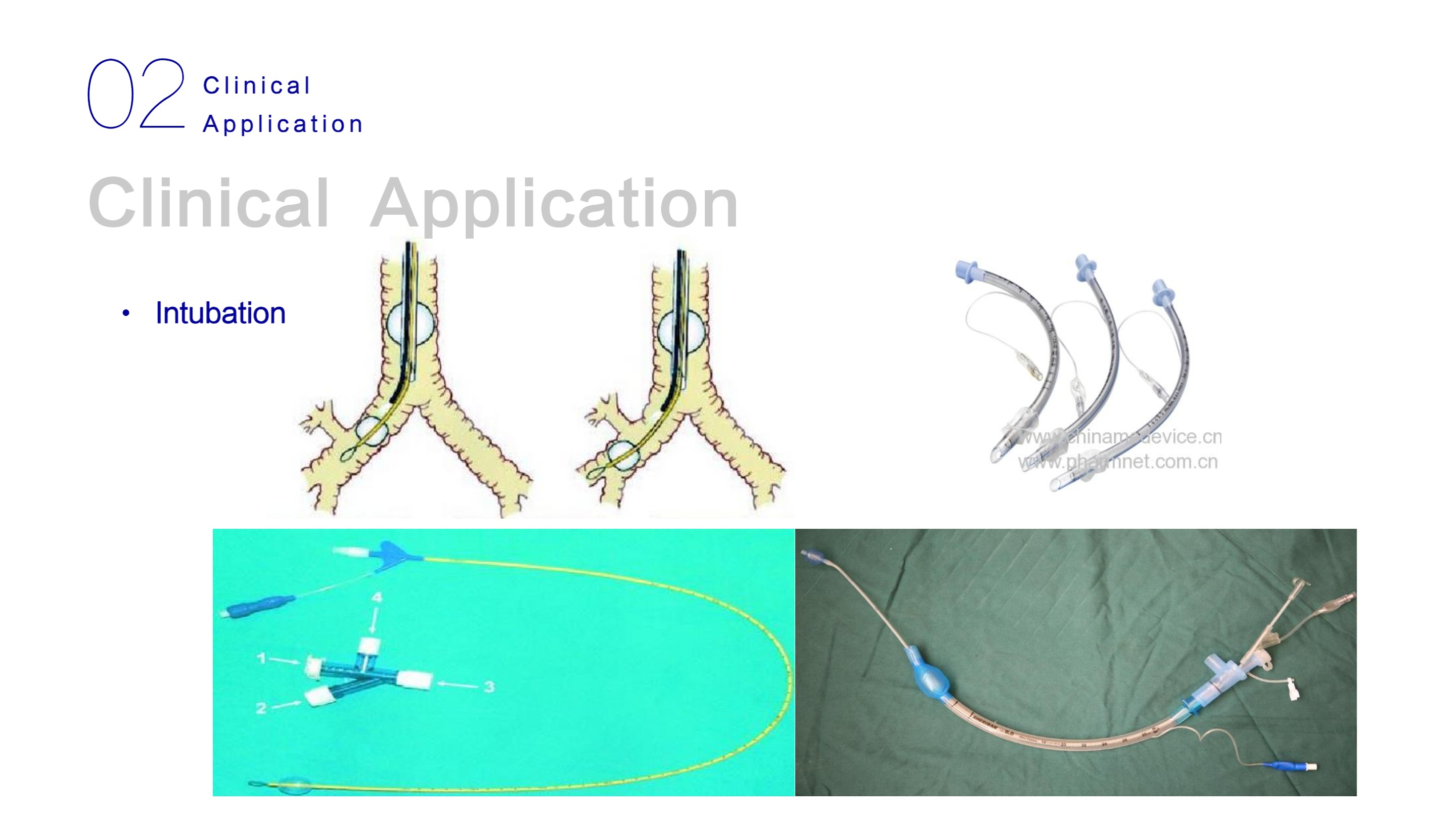 نظام التنظير المتنقل LHO-10-18