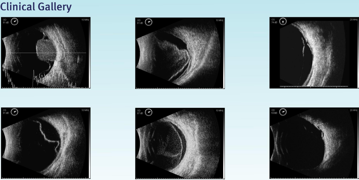 9b68f2bab403e752b954f4135795c2d2