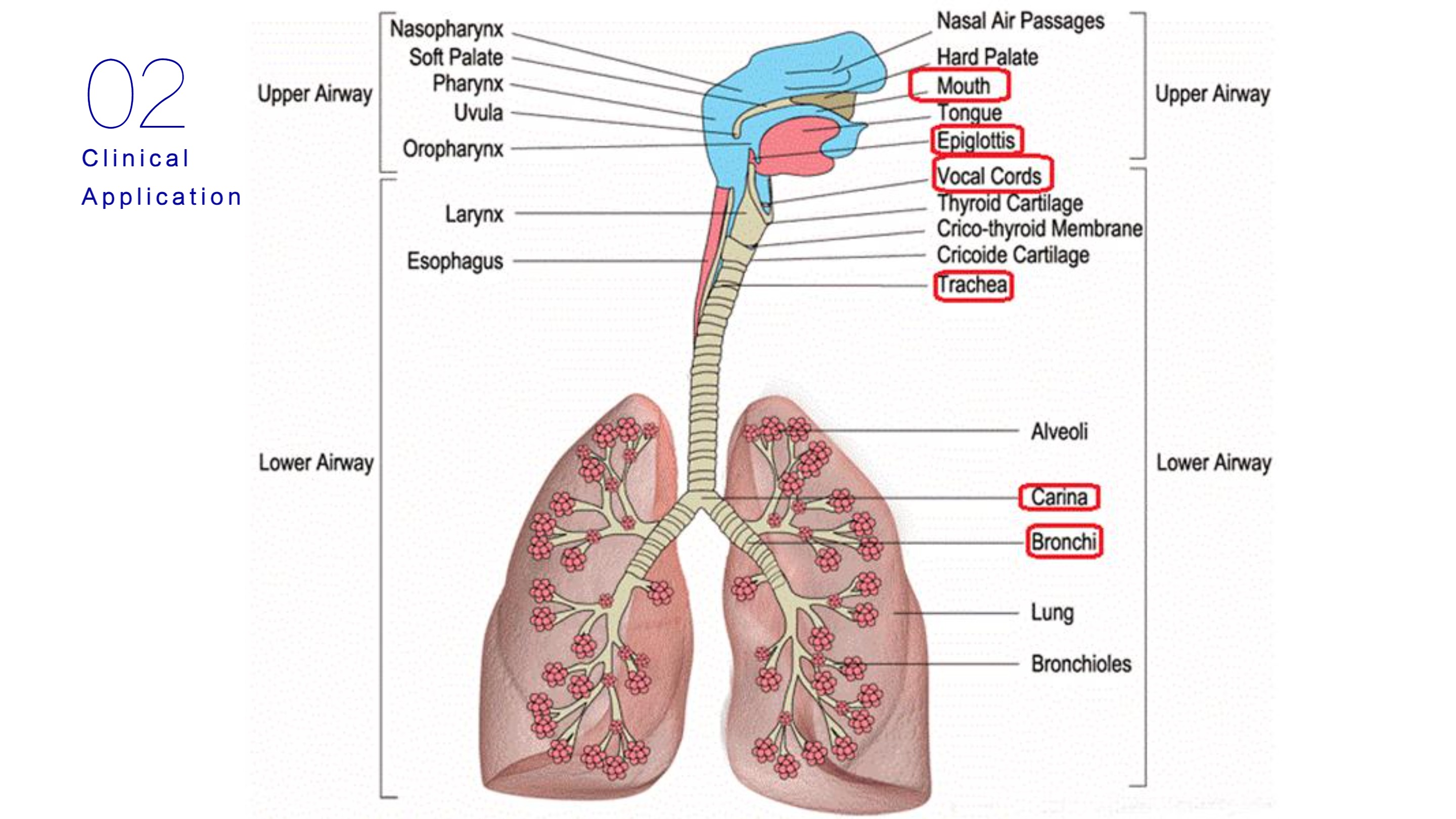نظام التنظير المتنقل LHO-10-14