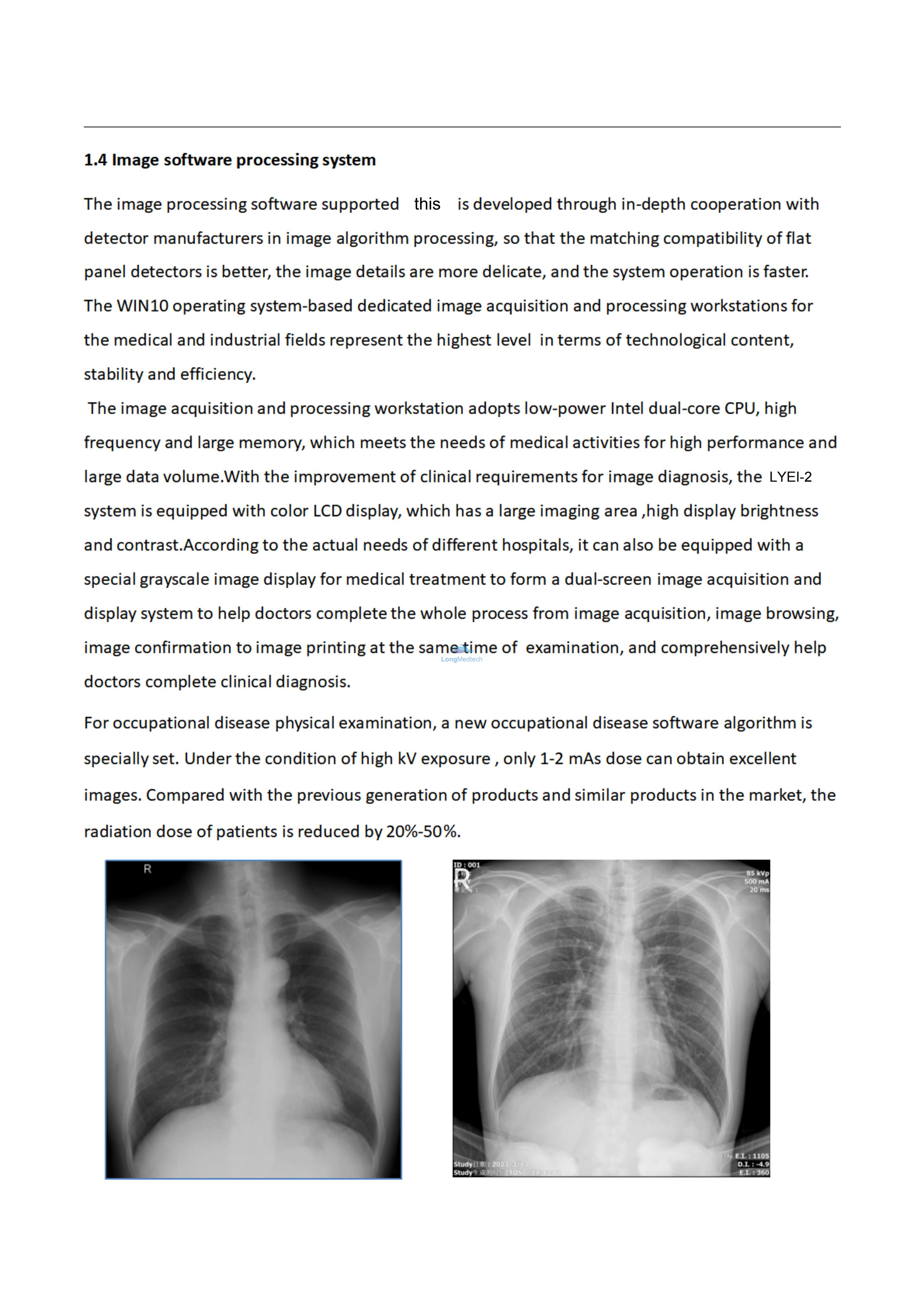 نظام التصوير الرقمي بالأشعة السينية LYEI-3_07