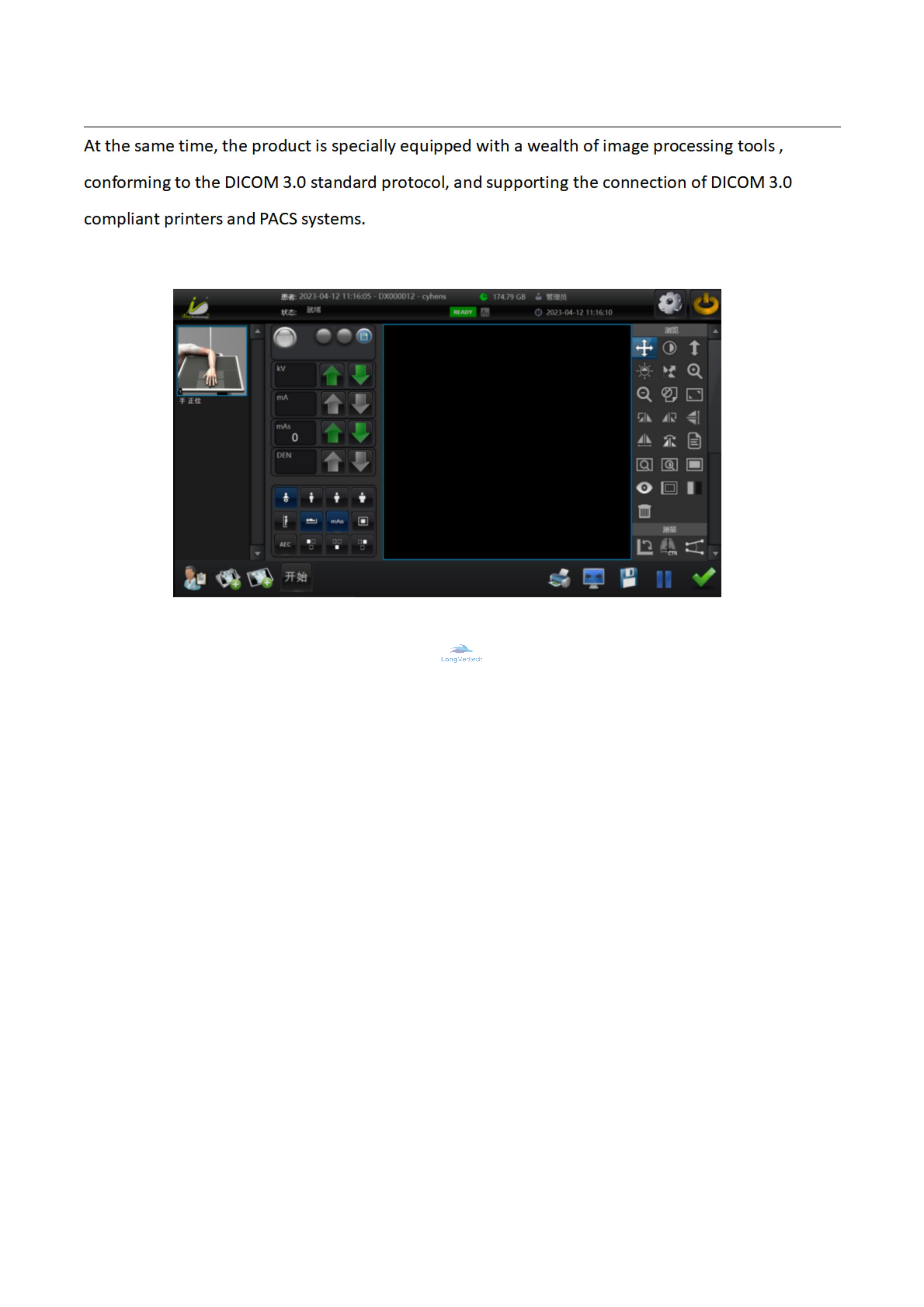 نظام التصوير الرقمي بالأشعة السينية LYEI-3_08
