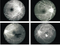 Caméra Fundus SK650A SK650B