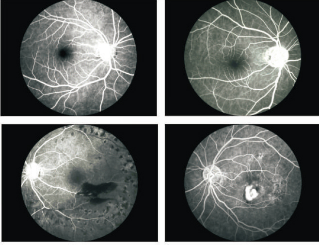 Caméra Fundus SK650A SK650B