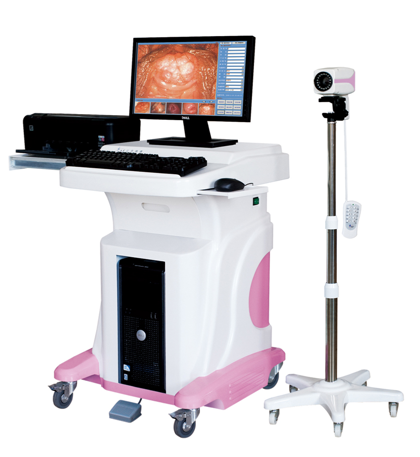 Jy-2620 Digital Video Colposcope in Hospital (model: Jy-2620)